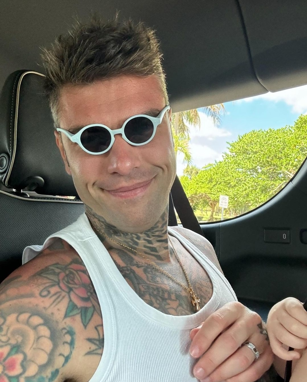 Probleme shëndetësore për Fedez: Reperi shtrohet me urgjencë në spital