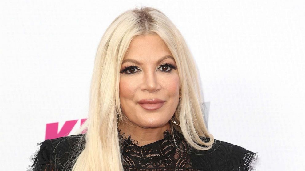 As 50 operacione nuk e rregullojnë dot, arsyeja pse Tori Spelling ka një vrimë të madhe në mes të gjoksit!