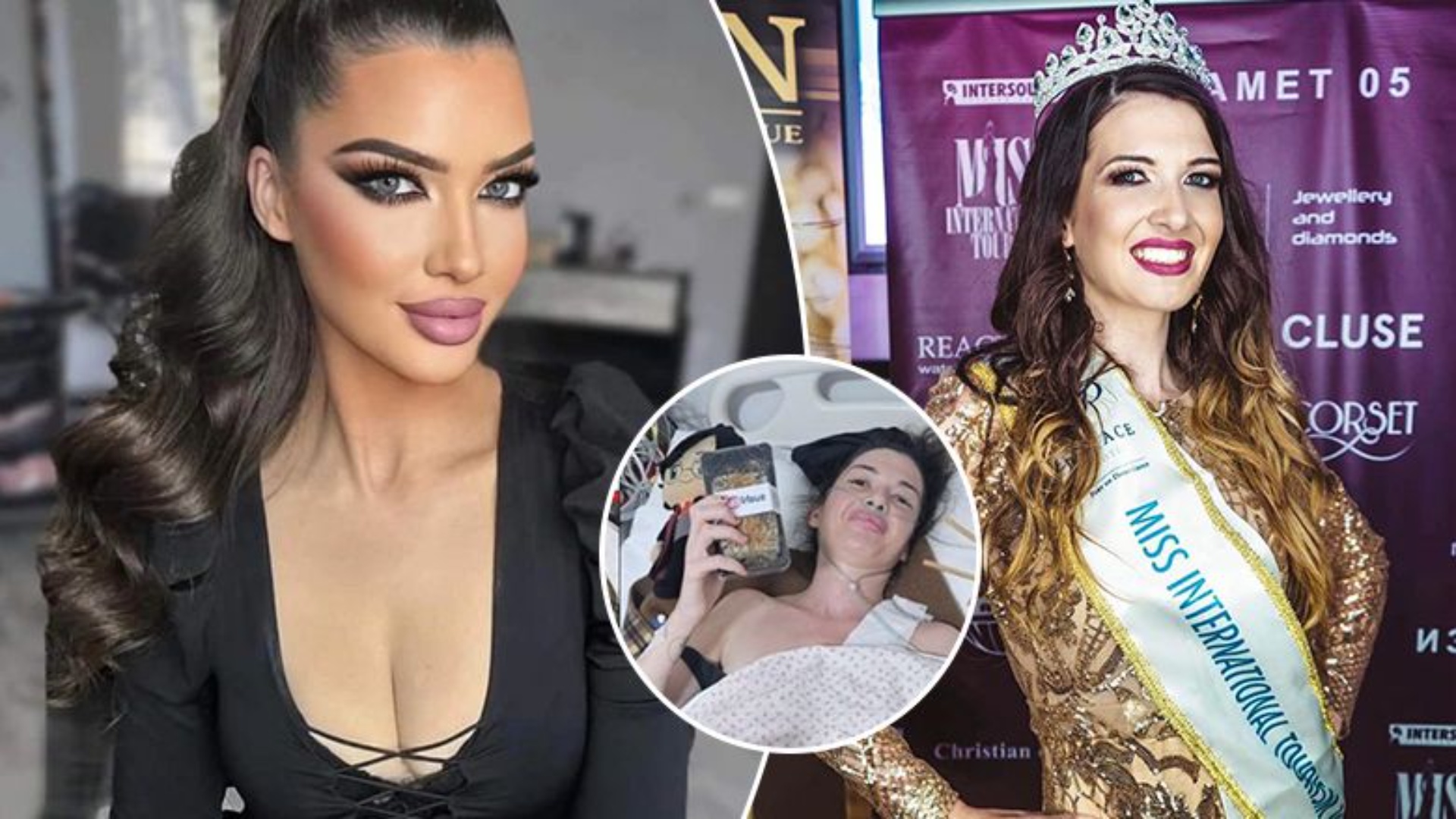 Miss-i i njohur bie nga lartësia dhe thyen 11 brinjë teksa po bënte ‘selfie’! Publikon foto nga spitali dhe ka një mesazh…