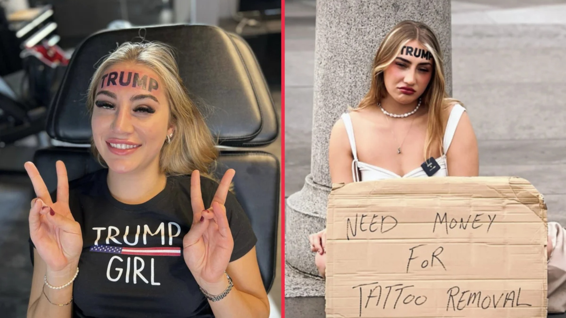 Bëri tatuazh emrin e Donald Trump në ballë, 21-vjeçarja tashmë kërkon fonde për ta hequr!